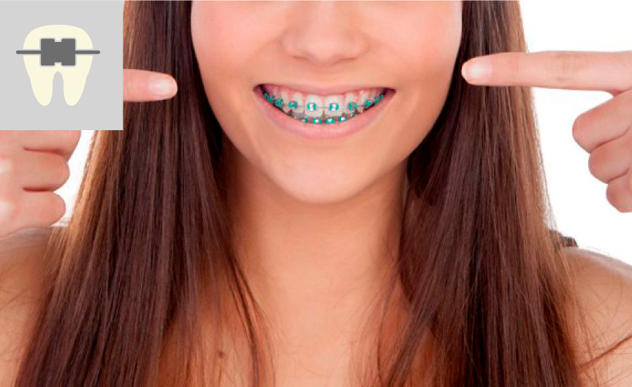 Brackets Metalicos